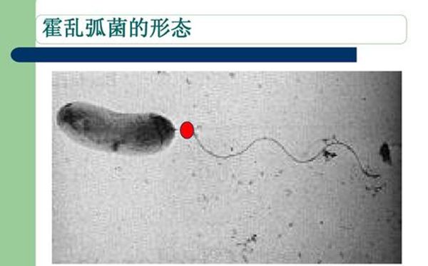霍亂孤菌的形態