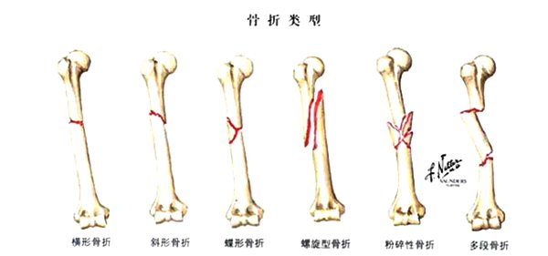 螞蟻莊園“寒潮橙色預(yù)警是什么等級
